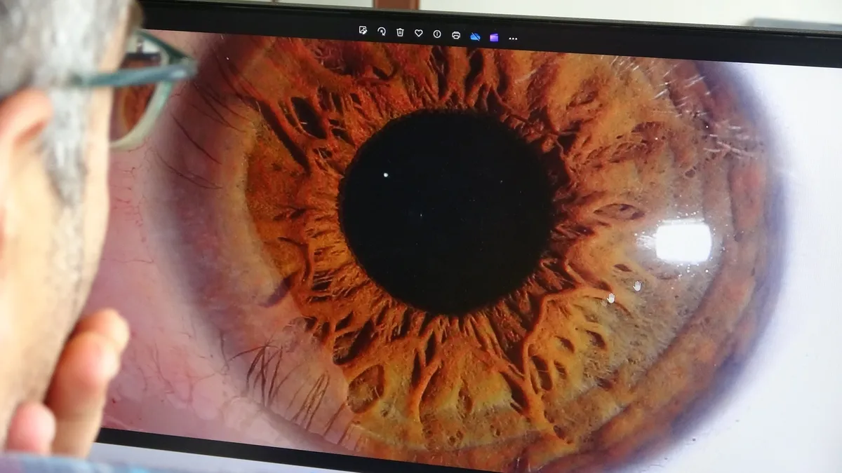 Sivas'ta “İris” fotoğrafçılığı ilgi görüyor