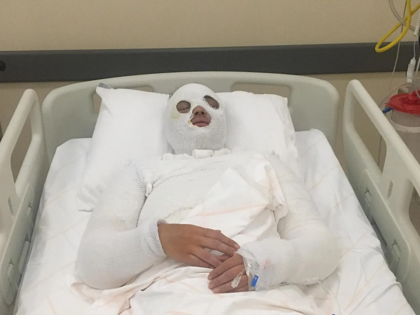 Eski nişanlıdan Merve Küçüktekin'e kezzaplı dehşet! Her detayı kan dondurdu