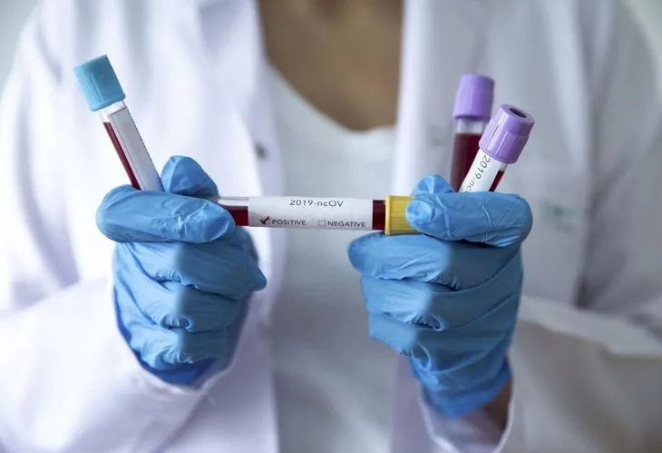Corona virüs koronavirüs testi hangi hastanelerde ücretsiz? Sağlık Bakanlığı liste yayınladı