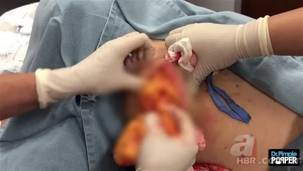 30 yıl boyunca baş ağrısıyla yaşadı! Nedeni şoke etti... 127