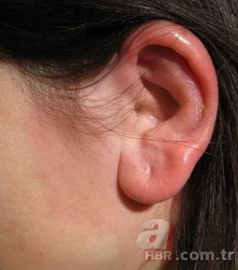 Kulak memesindeki çapraz çizgi ne işe yarar? 14
