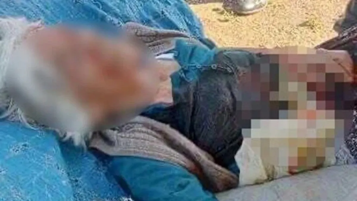 Niğde'de sokak köpeği dehşeti! Yaşlı kadın az kalsın parçalanıyordu