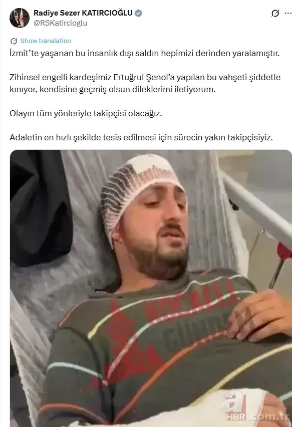 Otizmli vatandaşa “Niye bakıyorsun?” dayağı: Vicdan sahibi insan böyle bir şey yapmaz 7