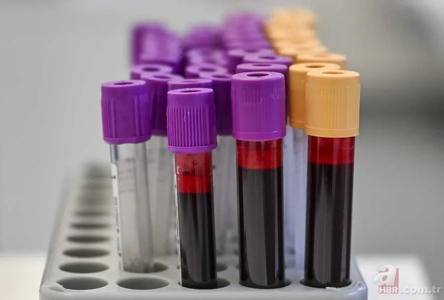 Vücudunuz ne kadar yaşlı? Biyolojik yaşı gösteren 10 belirti 2