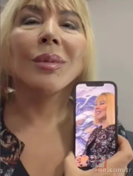 Estetiğin dozunu kaçıran Linet’in son hali şoke etti! “Parayla satın alınan çirkinlik” 25