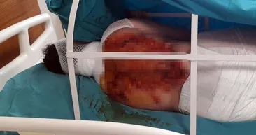 Üvey annesine kezzapla saldırdı! Nedeni ise dehşete düşürdü