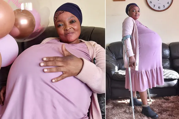 Dünya bu olayı konuşuyor! Rekor kırdı: Güney Afrikalı kadın 10 çocuk doğurdu