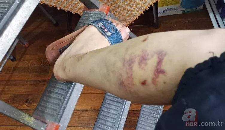 Ekrem İmamoğlu'nun danışmanı Murat Ongun'dan ısıran köpeğine koruma şikayetçi çalışana tehdit! Hem sahip çıkmadı hem işten kovdurdu 12