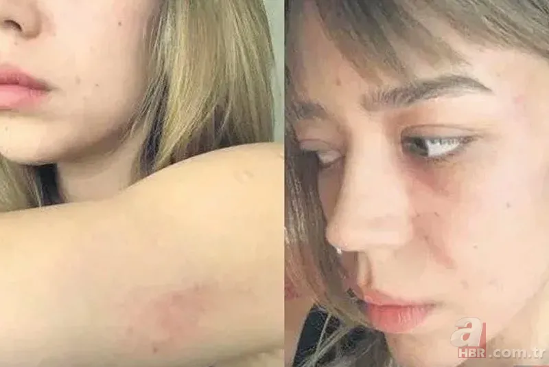 Özcan Deniz'den şiddet mi gördü? Feyza Aktan o fotoğraflara yanıt verdi 4